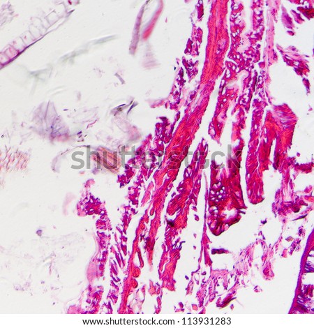  - stock-photo-science-micrograph-of-insects-body-cross-section-moth-caterpillar-prodenia-litura-with-he-dye-113931283