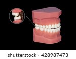Small photo of gnashing of teeth dental molars callouts