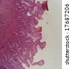 stock-photo-gall-bladder- ... stock-photo-gall-bladder- ...