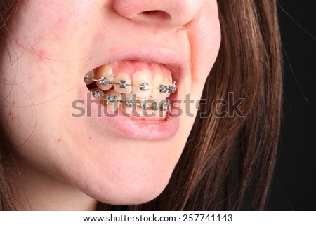 Bad teeth oral sex pictures