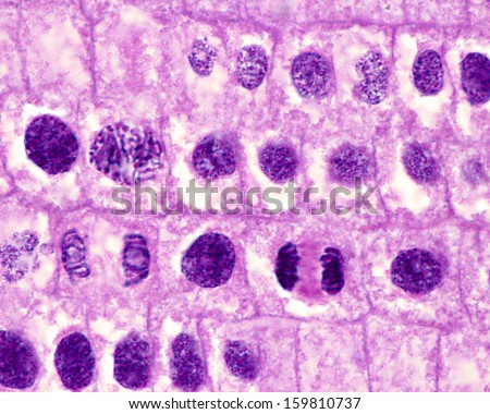 Micrograpf of mitosis in onion cells of the root meristem ... onion skin cell labeled diagram 