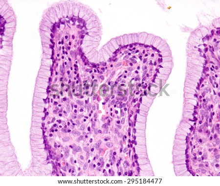 Ciliated Pseudostratified Columnar Epithelium Trachea Respiratory Stock ...