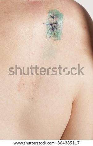 Contagion - Scratch / Aggress Contagion - Scratch / Aggress