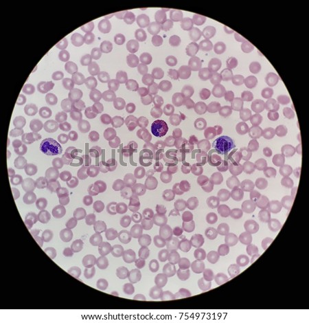 Human Peripheral Blood Smear Under 100x Stock Photo 758990203 ...