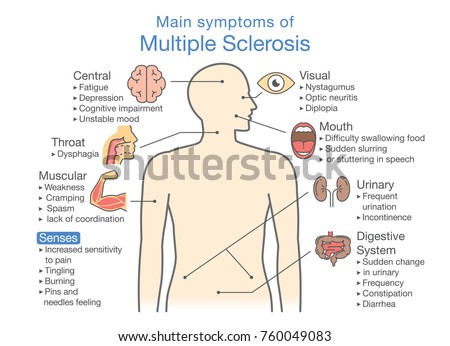 Organs Affected By Cardiogenic Shock Including Stock Vector 411146500 ...