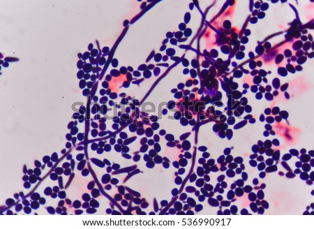 Budding Yeast Cells Pseudohyphae Urine Gram Stock Photo 309202415 ...