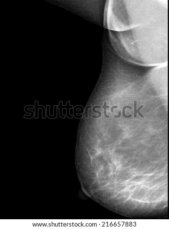 Mri breast cancer diagnosis can recommend Consider, Mri breast cancer diagnosis
