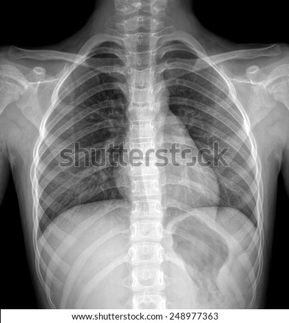 diagnostic breast x-ray pussies on display