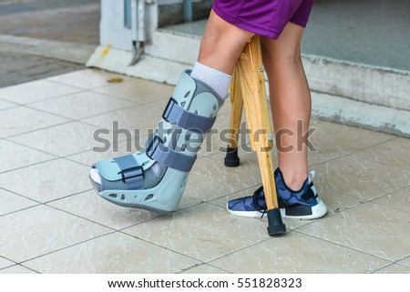 Broken Leg Splint Treatment Injuries Broken Stock Photo 552711946 ...