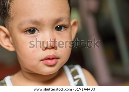 mouth disorders essay Essays hand, foot & mouth disease from hand-foot-mouth board with our cookie policy children are very much prone to acquiring different diseases and. mouth disorders essay Essays hand, foot & mouth disease from hand-foot-mouth board with our cookie policy children are very much prone to acquiring different diseases and.
