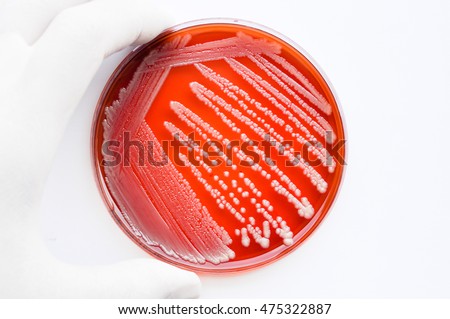 Salmonella Enteritidis Bacterial Colonies On Blood Stock Photo ...