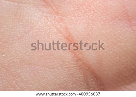 scar on human skin stock photo 209491861 scar on human skin stock photo 209491861 scar on human skin stock photo 209491861 scar on human skin stock photo 209491861