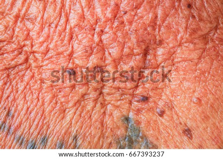 macro eczema on grip skin stock photo 7891171 macro eczema on grip skin stock photo 7891171 macro eczema on grip skin stock photo 7891171 macro eczema on grip skin stock photo 7891171
