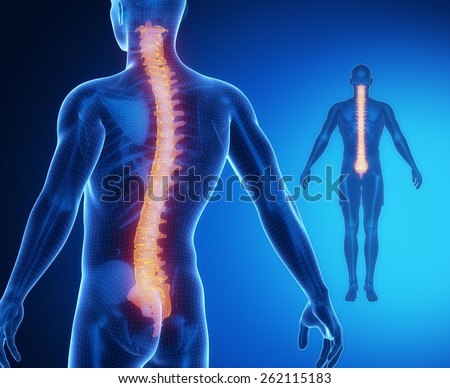 Herniated Disc Pressure On Spinal Cord Stock Illustration 107351057