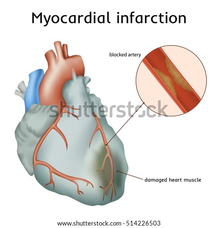 Illustration Circulatory System Capilary Blood Flow Stock ...
