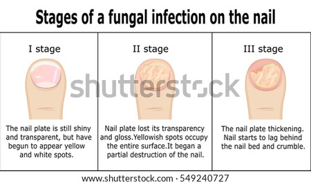 Circumcised penis images