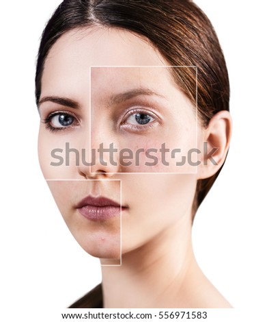Agree with Teen issues skin For Teen issues skin