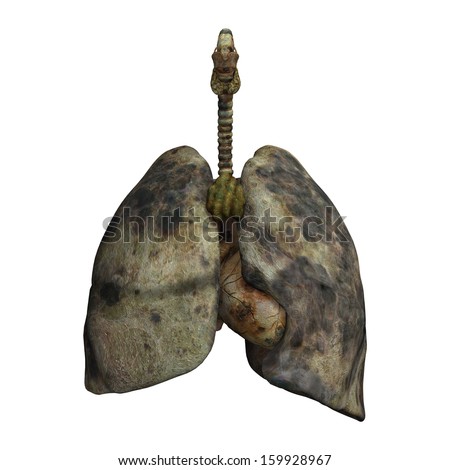 Set Lungs Before After Lifetime Smoking Stock Illustration 147525569 ...