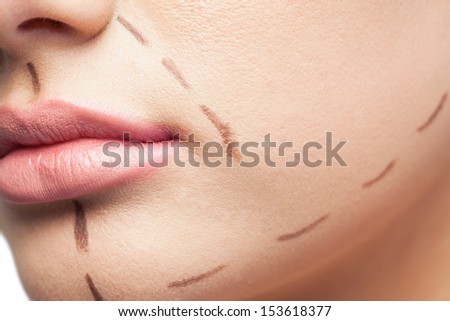 scar on human skin stock photo 209491861 scar on human skin keloid appendectomy stock photo 441039274 scar on human skin stock photo 209491861 scar on human skin keloid appendectomy stock photo 441039274