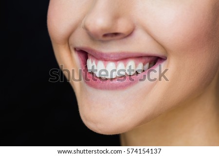 Close Bad Crooked Teeth Girl Stock Photo 48513667 - Shutterstock