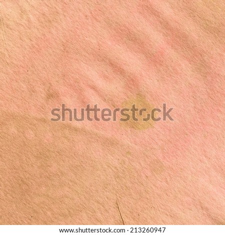 burn scar stock photo 57476164 burn scar stock photo 57476164 burn scar stock photo 57476164 burn scar stock photo 57476164