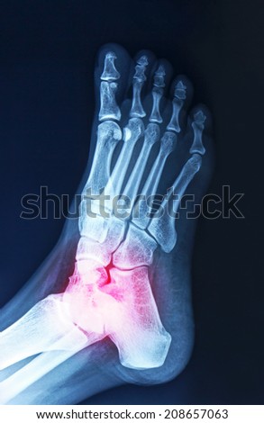 Color photos of arthritis